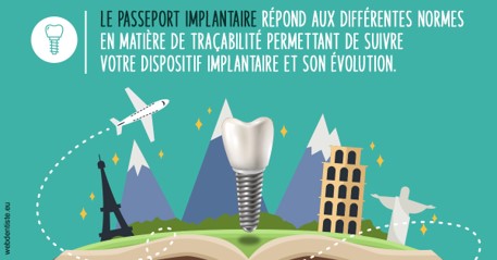 https://dr-faboumy-marc-olivier.chirurgiens-dentistes.fr/Le passeport implantaire