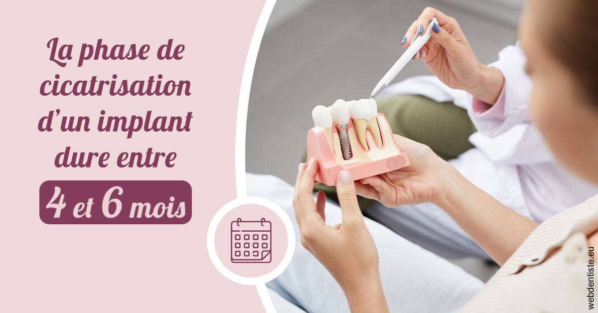 https://dr-faboumy-marc-olivier.chirurgiens-dentistes.fr/Cicatrisation implant 2