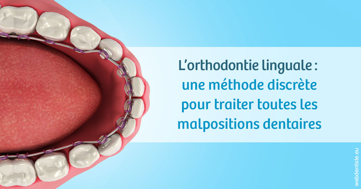 https://dr-faboumy-marc-olivier.chirurgiens-dentistes.fr/L'orthodontie linguale 1