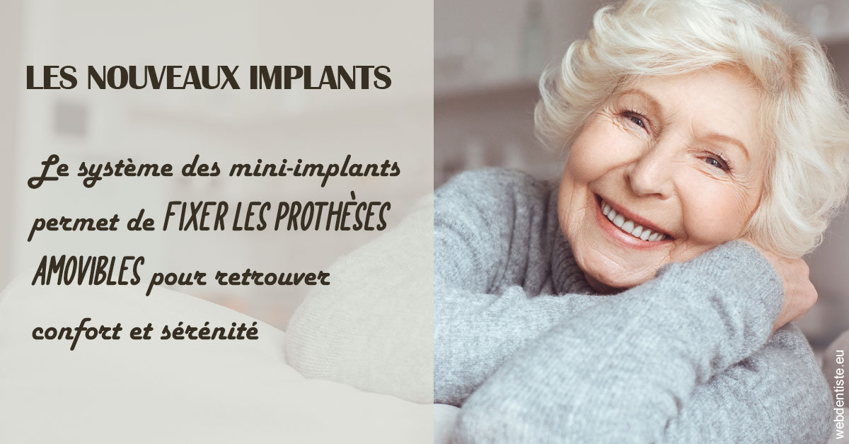 https://dr-faboumy-marc-olivier.chirurgiens-dentistes.fr/Les nouveaux implants 1