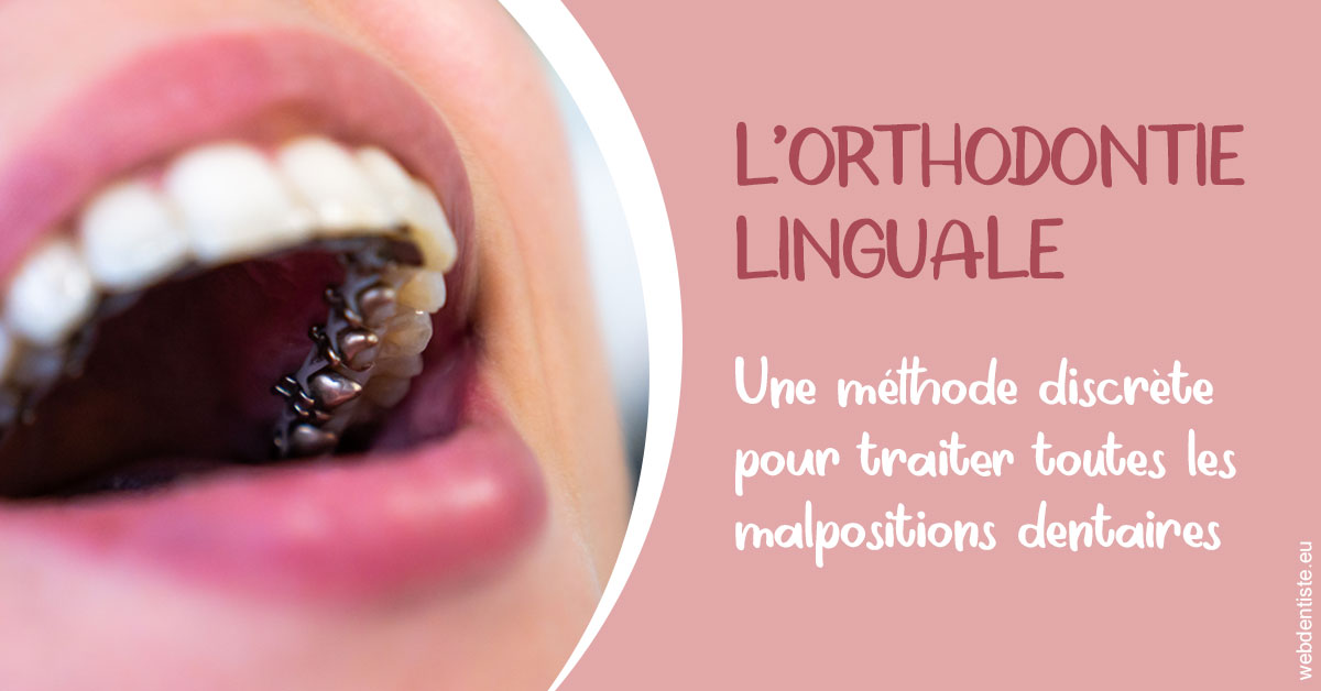 https://dr-faboumy-marc-olivier.chirurgiens-dentistes.fr/L'orthodontie linguale 2