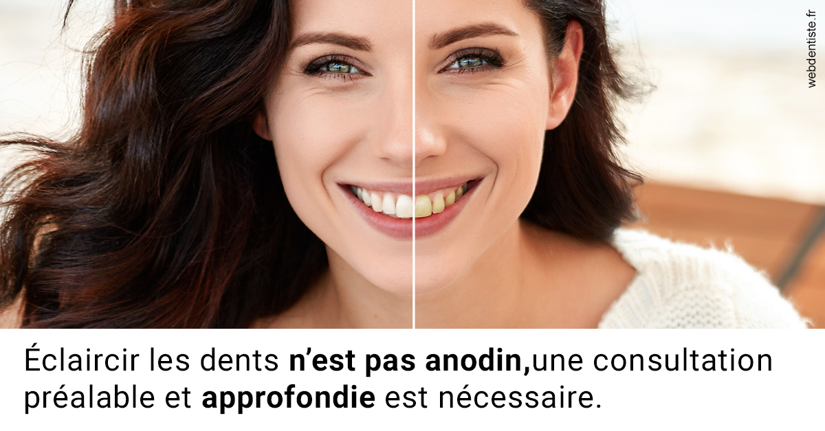 https://dr-faboumy-marc-olivier.chirurgiens-dentistes.fr/Le blanchiment 2