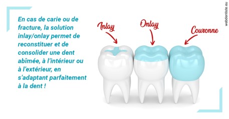 https://dr-faboumy-marc-olivier.chirurgiens-dentistes.fr/L'INLAY ou l'ONLAY