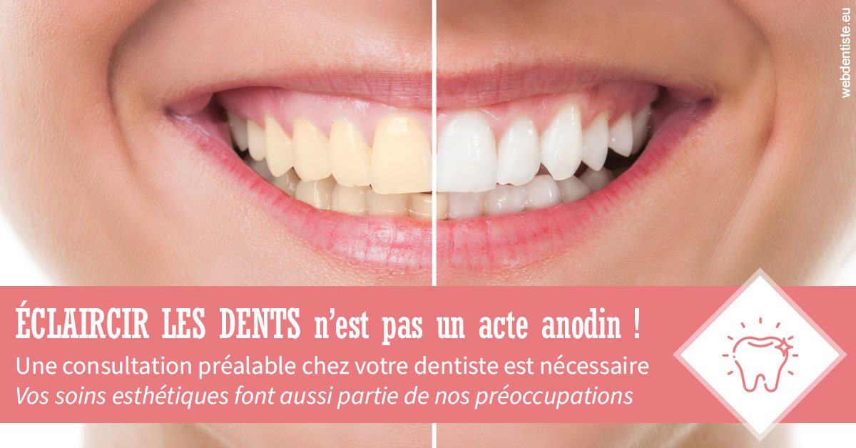 https://dr-faboumy-marc-olivier.chirurgiens-dentistes.fr/Eclaircir les dents 1