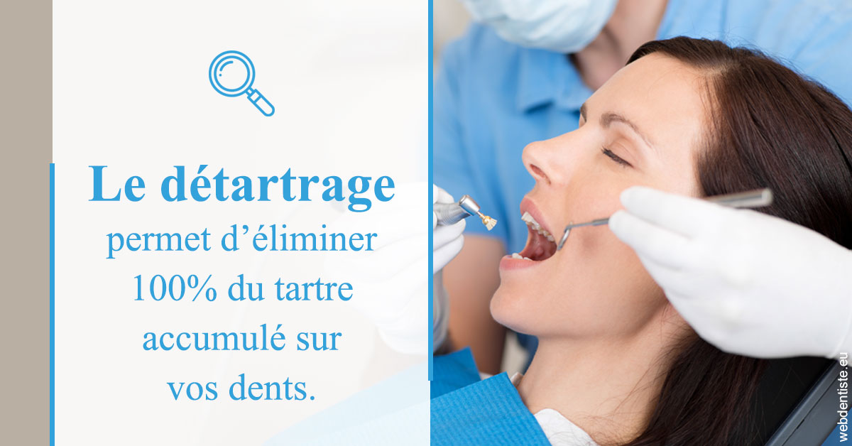 https://dr-faboumy-marc-olivier.chirurgiens-dentistes.fr/En quoi consiste le détartrage