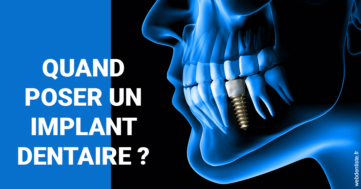https://dr-faboumy-marc-olivier.chirurgiens-dentistes.fr/Les implants 1