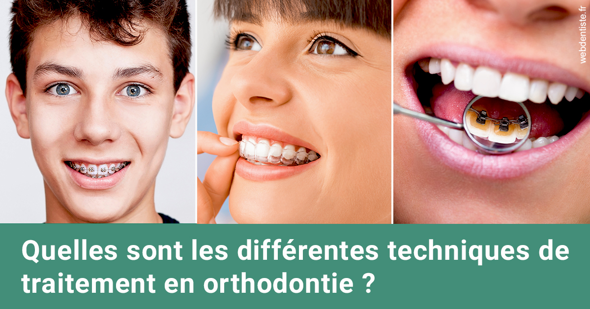 https://dr-faboumy-marc-olivier.chirurgiens-dentistes.fr/Les différentes techniques de traitement 2