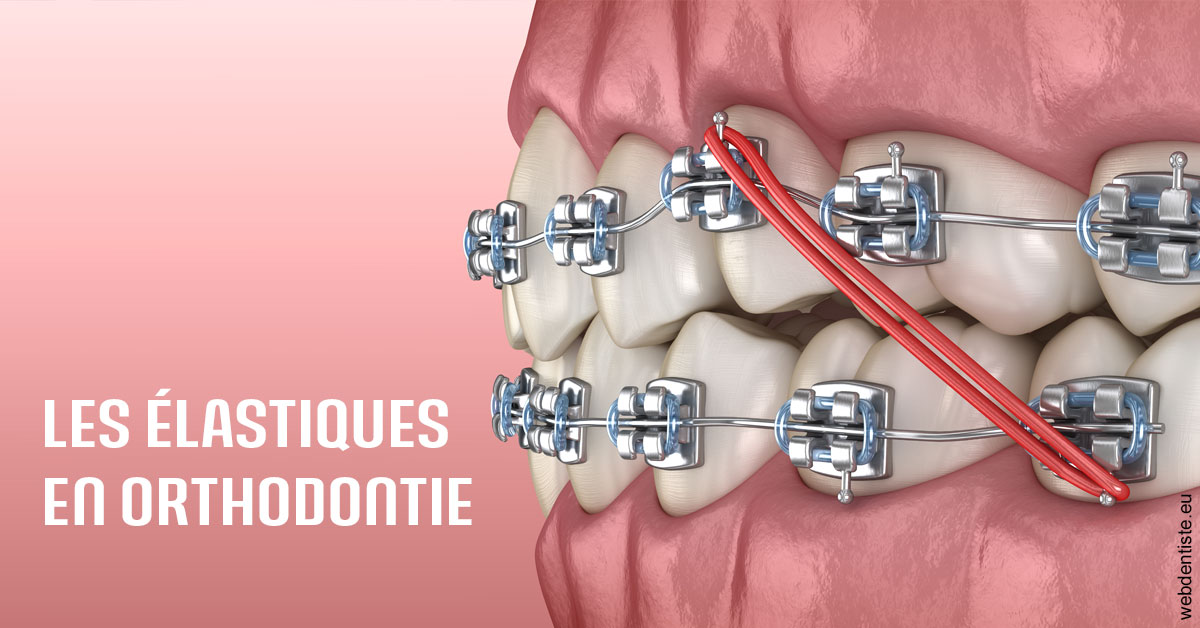 https://dr-faboumy-marc-olivier.chirurgiens-dentistes.fr/Elastiques orthodontie 2