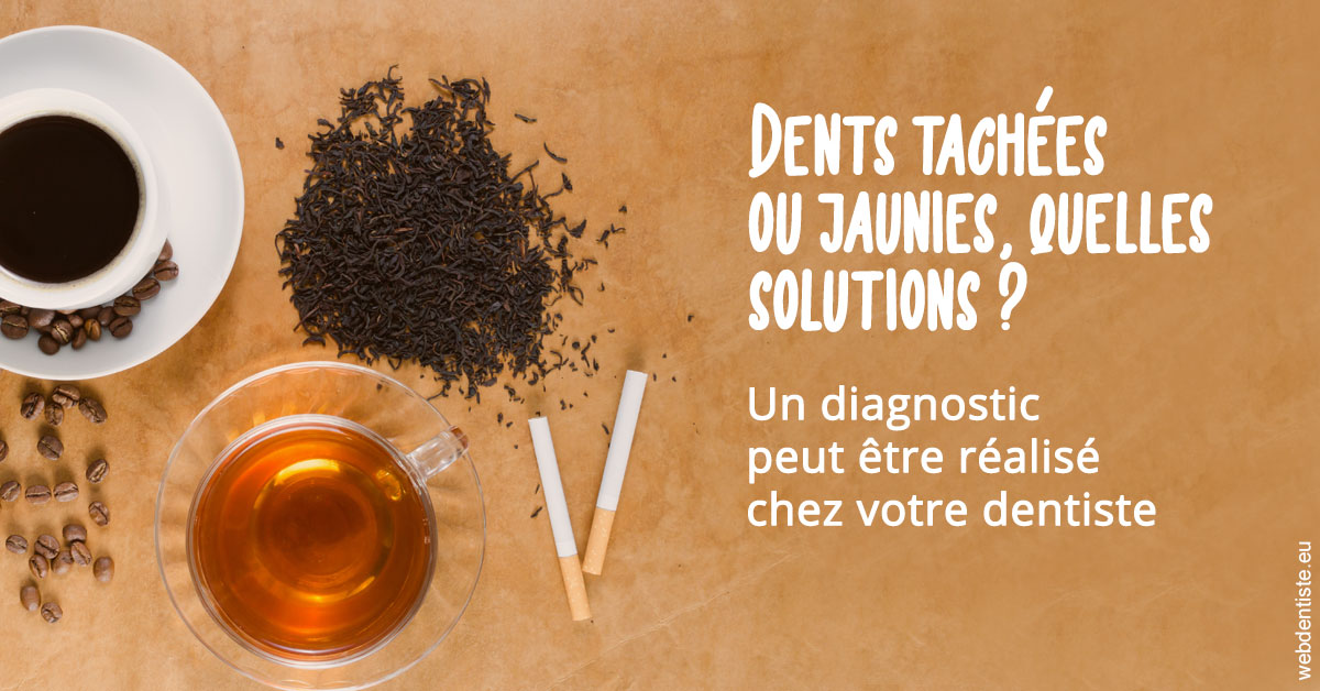 https://dr-faboumy-marc-olivier.chirurgiens-dentistes.fr/Dents tachées 2