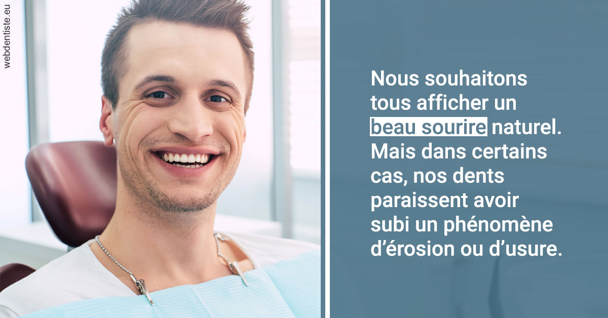 https://dr-faboumy-marc-olivier.chirurgiens-dentistes.fr/Érosion et usure dentaire