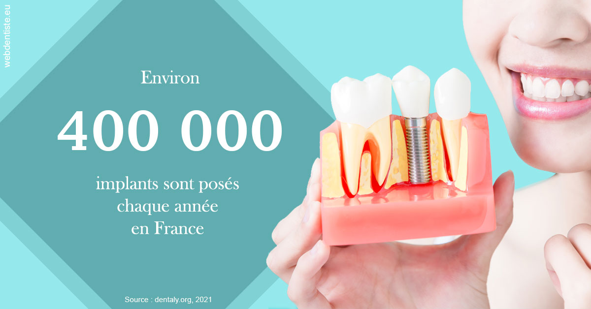 https://dr-faboumy-marc-olivier.chirurgiens-dentistes.fr/Pose d'implants en France 2